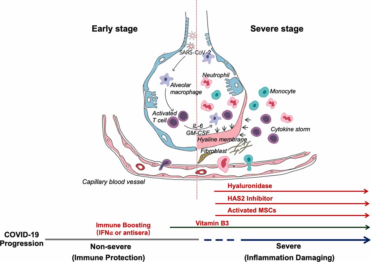 Schematic representation of the progression of COVID-19 infection